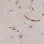 COBLL1 Antibody in Immunohistochemistry (IHC)