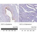 CST11 Antibody in Immunohistochemistry (IHC)