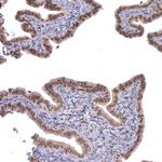 BTBD7 Antibody in Immunohistochemistry (Paraffin) (IHC (P))