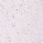 BTBD7 Antibody in Immunohistochemistry (Paraffin) (IHC (P))