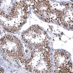BTBD7 Antibody in Immunohistochemistry (Paraffin) (IHC (P))