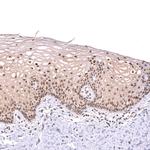 BTBD7 Antibody in Immunohistochemistry (Paraffin) (IHC (P))