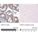BTBD7 Polyclonal Antibody