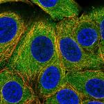 DESI1 Polyclonal Antibody