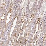 DESI1 Antibody in Immunohistochemistry (Paraffin) (IHC (P))