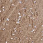 PPFIA4 Antibody in Immunohistochemistry (Paraffin) (IHC (P))