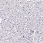 PPFIA4 Antibody in Immunohistochemistry (Paraffin) (IHC (P))