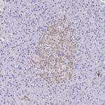 PPFIA4 Polyclonal Antibody