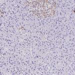 PPFIA4 Antibody in Immunohistochemistry (IHC)