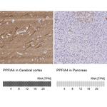PPFIA4 Antibody