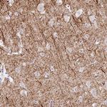 EMC4 Polyclonal Antibody