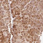 RGL2 Polyclonal Antibody