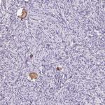 SNX31 Polyclonal Antibody