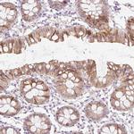 SPRYD4 Antibody in Immunohistochemistry (Paraffin) (IHC (P))