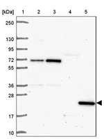 SPRYD4 Antibody in Western Blot (WB)