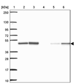 AGK Antibody in Western Blot (WB)