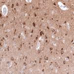 TTYH3 Antibody in Immunohistochemistry (Paraffin) (IHC (P))