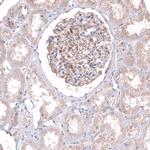 TTYH3 Antibody in Immunohistochemistry (Paraffin) (IHC (P))