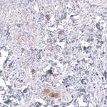 TTYH3 Polyclonal Antibody