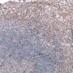TTYH3 Antibody in Immunohistochemistry (Paraffin) (IHC (P))