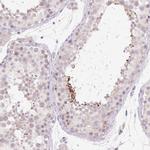 BRUNOL6 Antibody in Immunohistochemistry (Paraffin) (IHC (P))