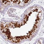 C13orf27 Polyclonal Antibody