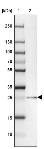 C13orf27 Antibody in Western Blot (WB)