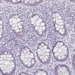 LENG9 Antibody in Immunohistochemistry (Paraffin) (IHC (P))