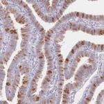 WDR54 Antibody in Immunohistochemistry (Paraffin) (IHC (P))