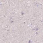 WDR54 Antibody in Immunohistochemistry (IHC)