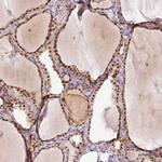 FAM179B Polyclonal Antibody