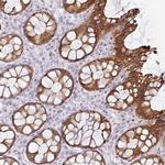 GTF2H3 Polyclonal Antibody