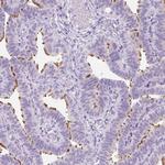 TMEM89 Polyclonal Antibody