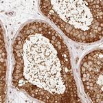 C10orf76 Antibody in Immunohistochemistry (Paraffin) (IHC (P))