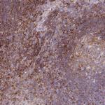 Coronin 7 Polyclonal Antibody