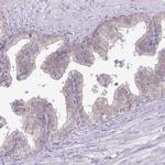 DREV Antibody in Immunohistochemistry (Paraffin) (IHC (P))