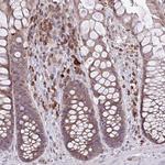DREV Antibody in Immunohistochemistry (Paraffin) (IHC (P))