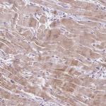 KRTAP20-3 Antibody in Immunohistochemistry (Paraffin) (IHC (P))