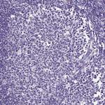 KRTAP20-3 Antibody in Immunohistochemistry (Paraffin) (IHC (P))