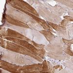 KRTAP20-3 Antibody in Immunohistochemistry (Paraffin) (IHC (P))