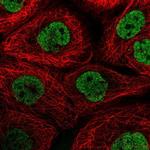 NPIPA1 Polyclonal Antibody