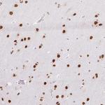NPIPA1 Antibody in Immunohistochemistry (Paraffin) (IHC (P))