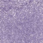 DHRS11 Antibody in Immunohistochemistry (IHC)