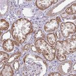 RPLP2 Antibody in Immunohistochemistry (Paraffin) (IHC (P))