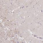 IP6K3 Polyclonal Antibody