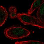 CYHR1 Polyclonal Antibody