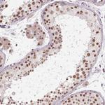 CYHR1 Antibody in Immunohistochemistry (IHC)