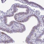 SPAG1 Polyclonal Antibody