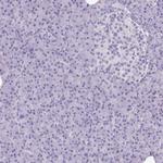 SPAG1 Antibody in Immunohistochemistry (Paraffin) (IHC (P))