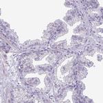 SPAG1 Antibody in Immunohistochemistry (Paraffin) (IHC (P))